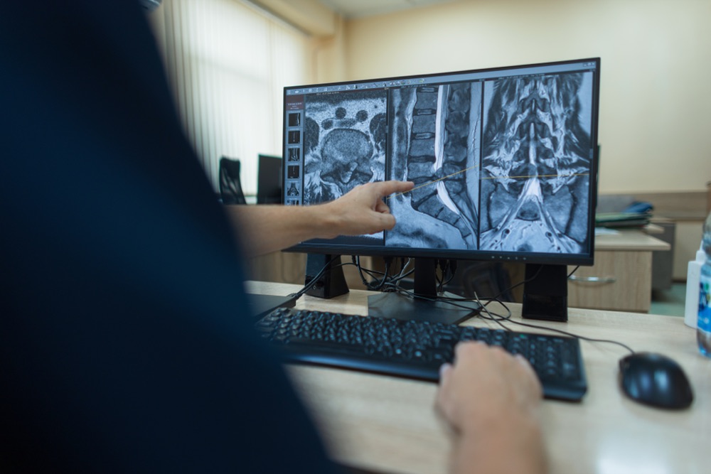 A radiologist pointing at an MRI on screen